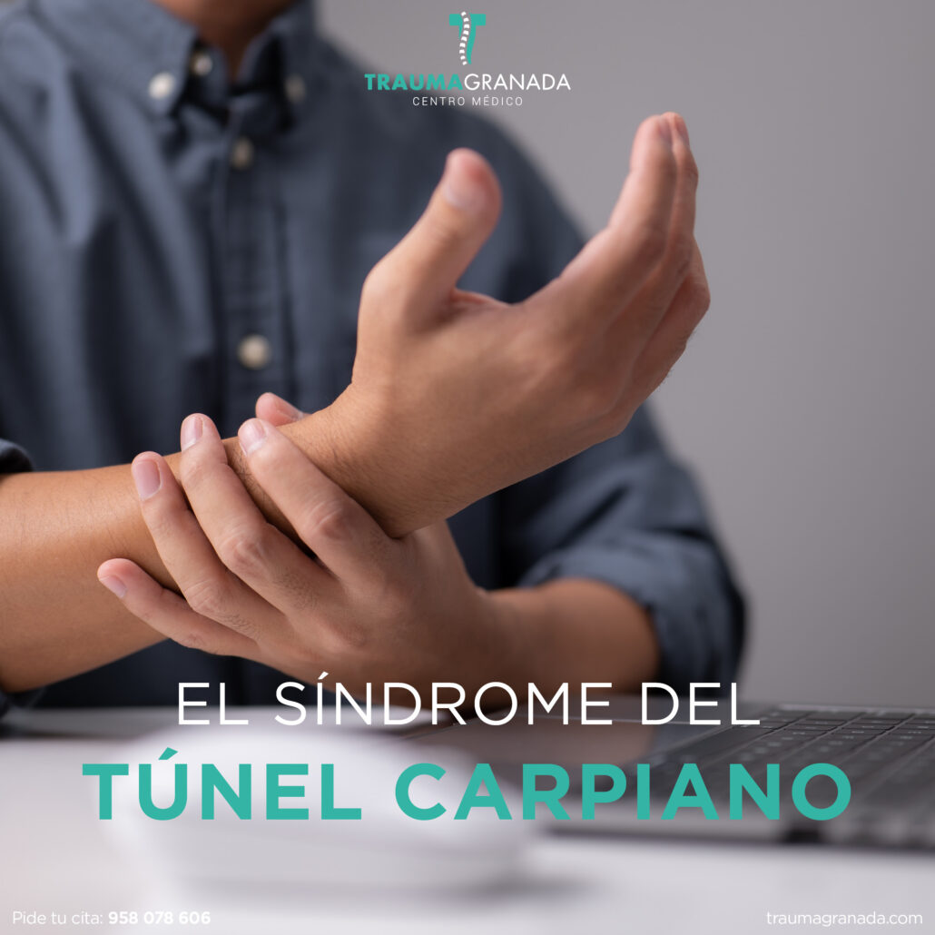 https://traumagranada.com/wp-content/uploads/2023/06/El-sindrome-del-tunel-carpiano-2--1030x1030.jpg